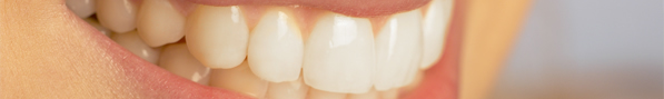 affordable dental veneers, porcelain dental implants, price of veneers, price for veneers, porcelain veneers lake forest